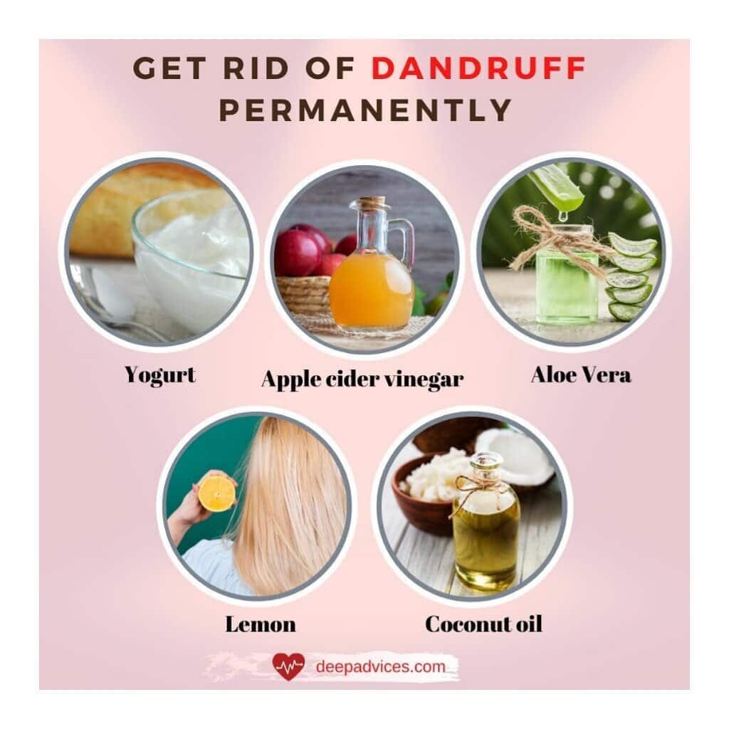 cure dandruff permanently naturally at home