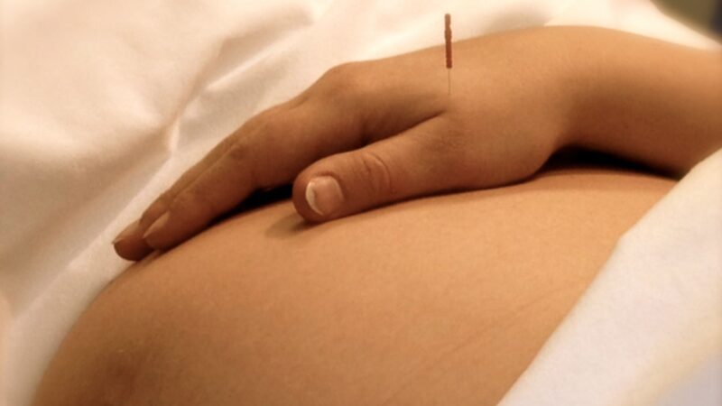 How Acupuncture Can Benefit You While Pregnant