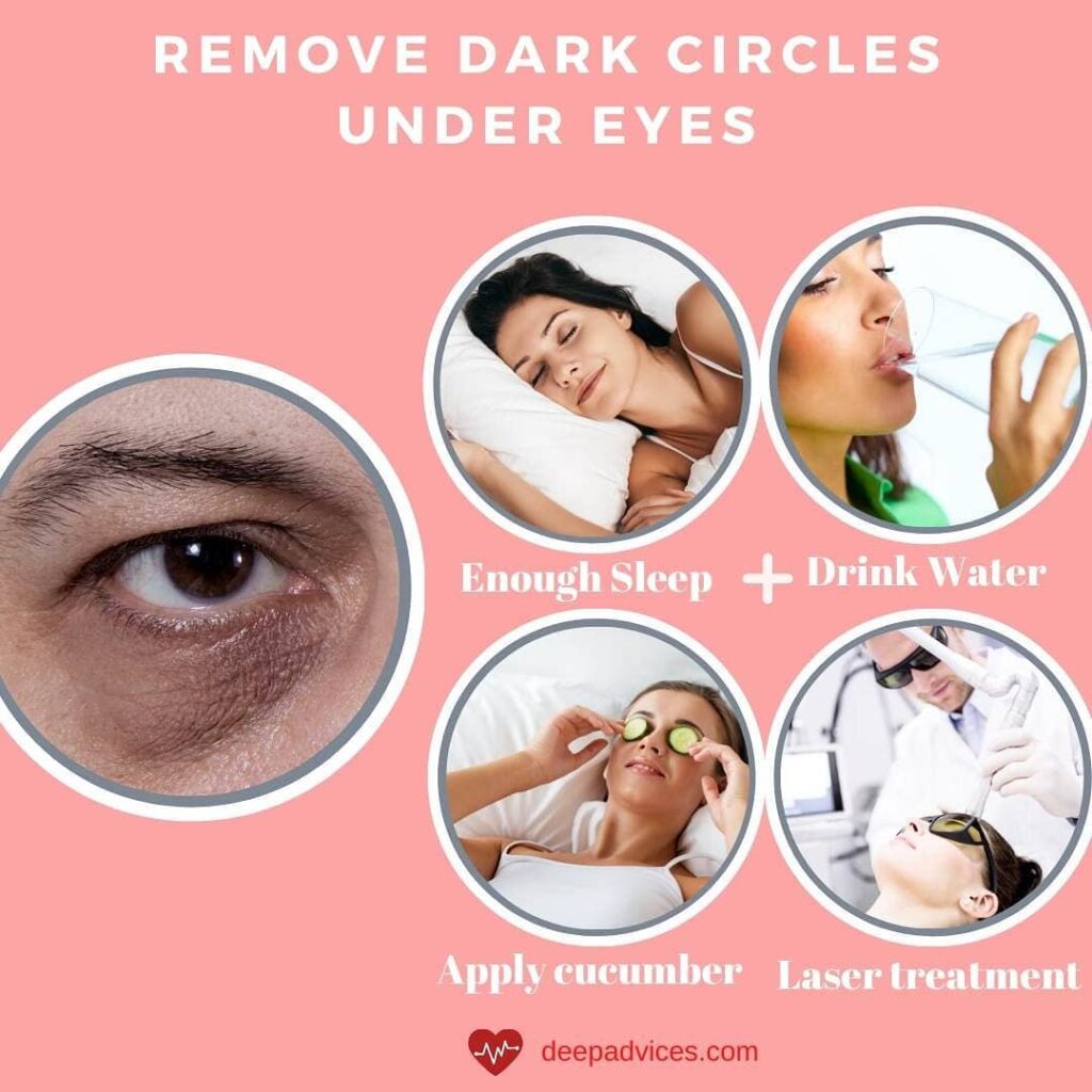 How to Remove Dark Circles Under Eyes Permanently at Home