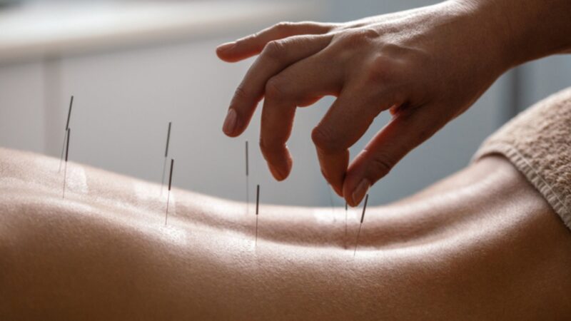 Is Acupuncture Effective For Weight Loss