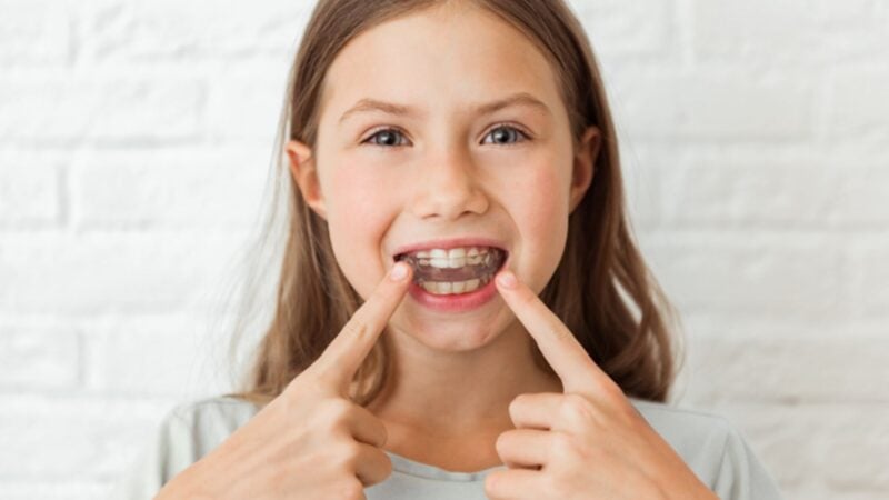 What Age Can a Child Start Invisalign